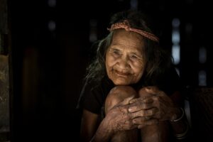 ミノキシジルは女性の薄毛にどのような効果があるのか？